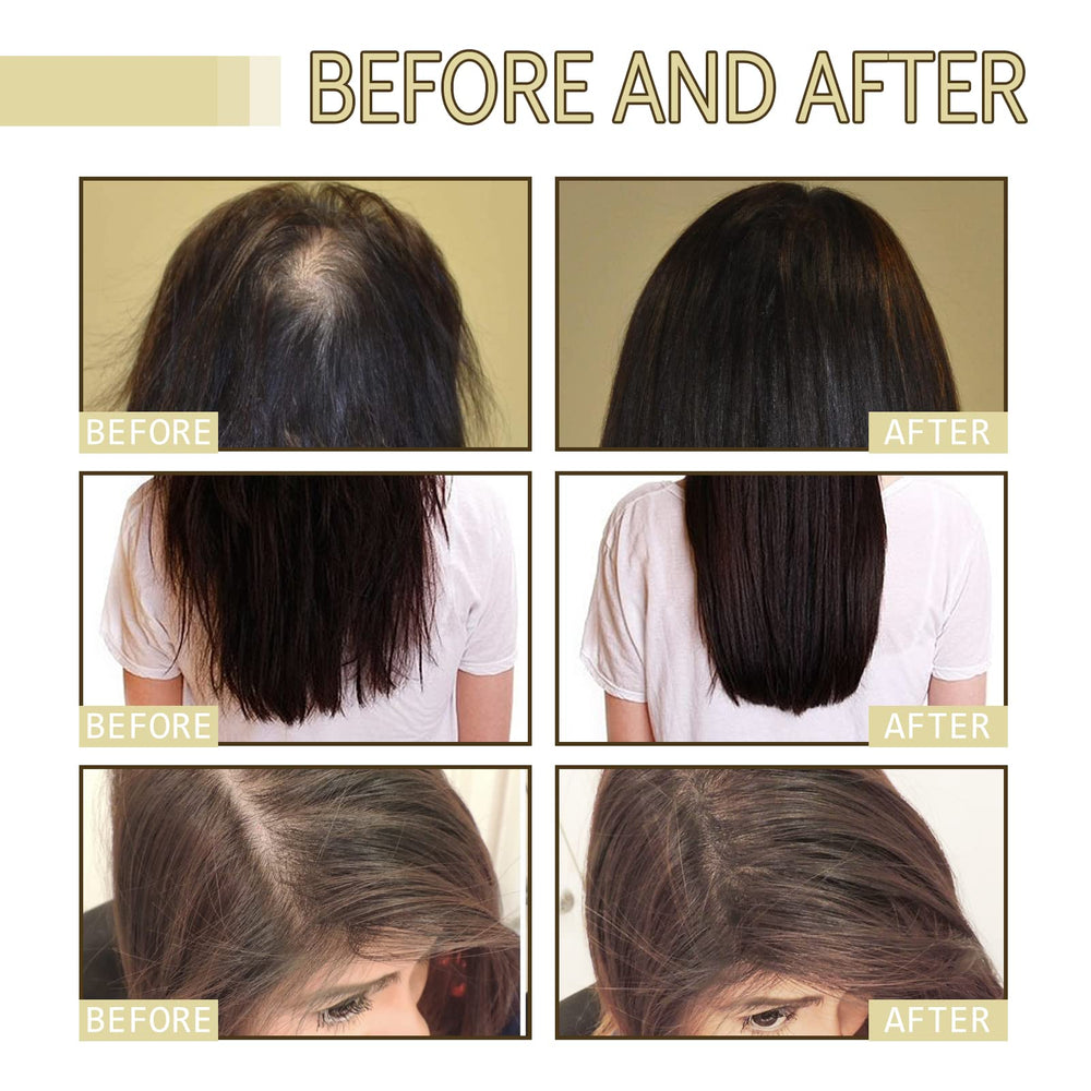 Deuiosna Carvenchi scalp massage application demonstrating usage.