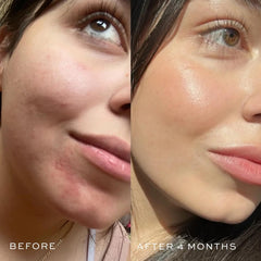 DIME Aceite facial azul: ingredientes naturales que nutren la piel.