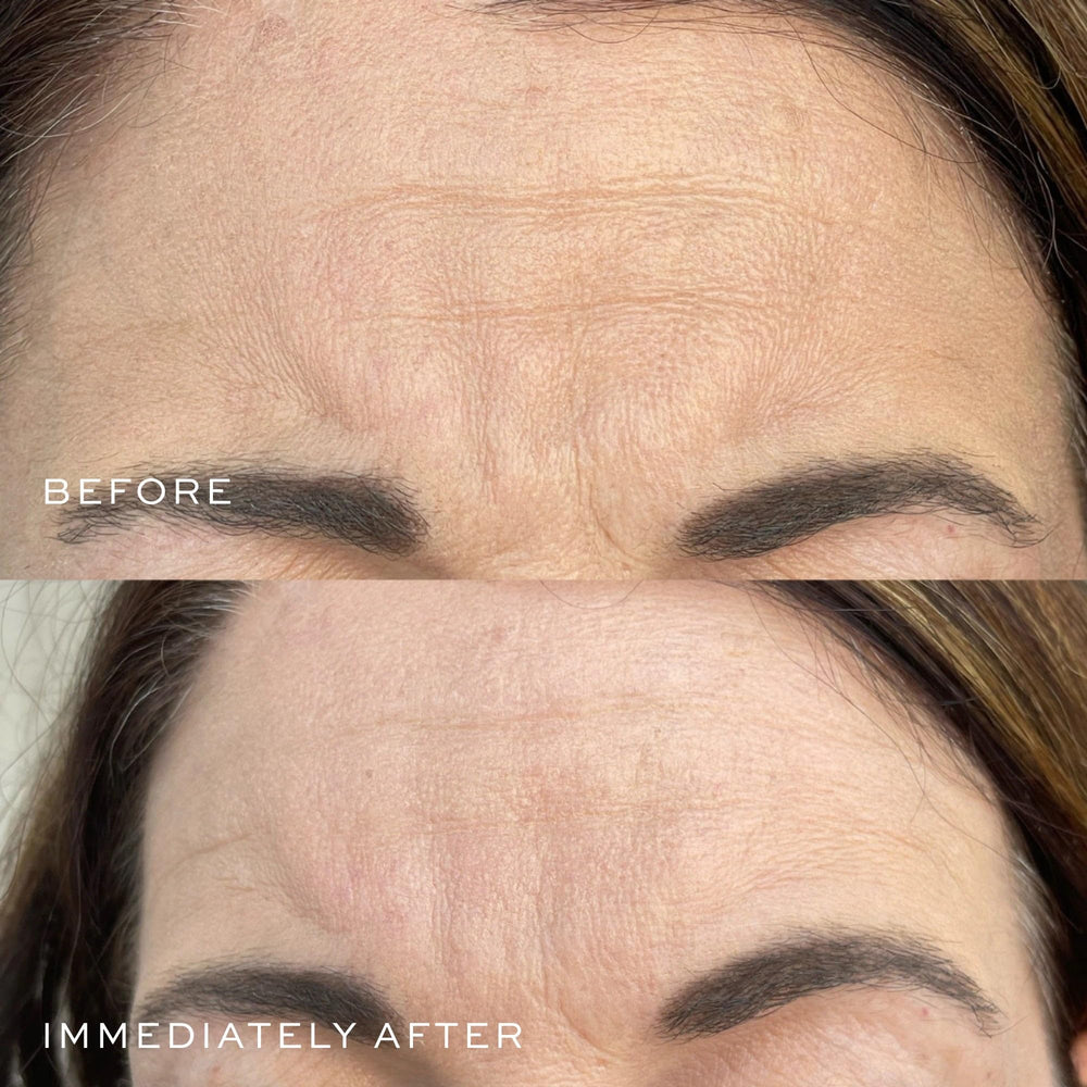 DIME Beauty Super Firm Serum ingredientes clave para firmeza
