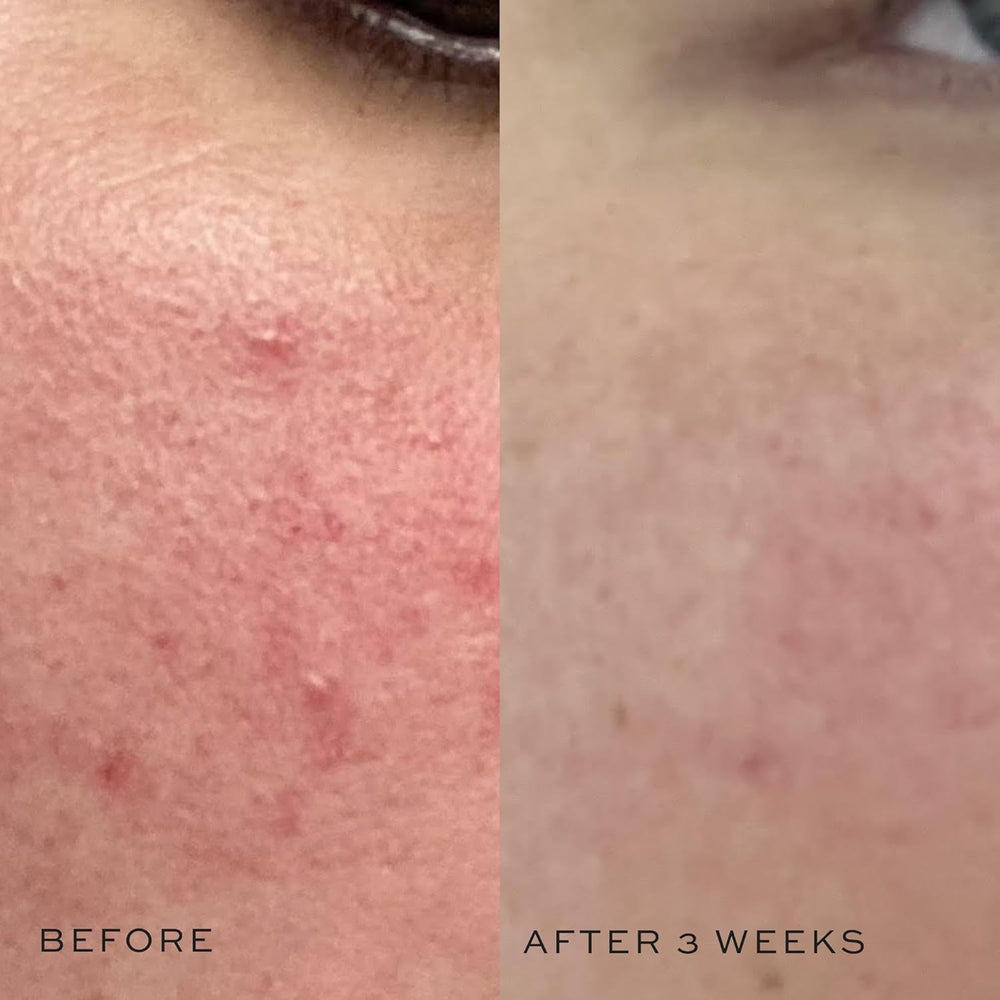 Tonique DIME – concombre pour rafraîchir et hydrater la peau.