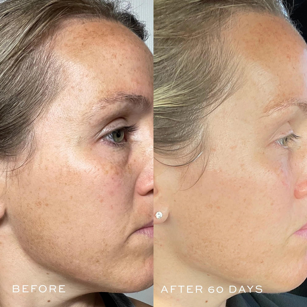 Aplicación en rostro con el DIME TBT Serum para uso matutino y nocturno