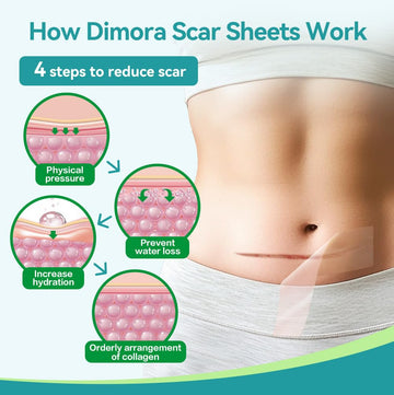 Dimora hypoallergenic silicone material, suitable for sensitive skin and all ages.