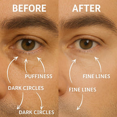 Disco Serum yeux anti-âge Roller : ciblé et atténue cernes et ridules.