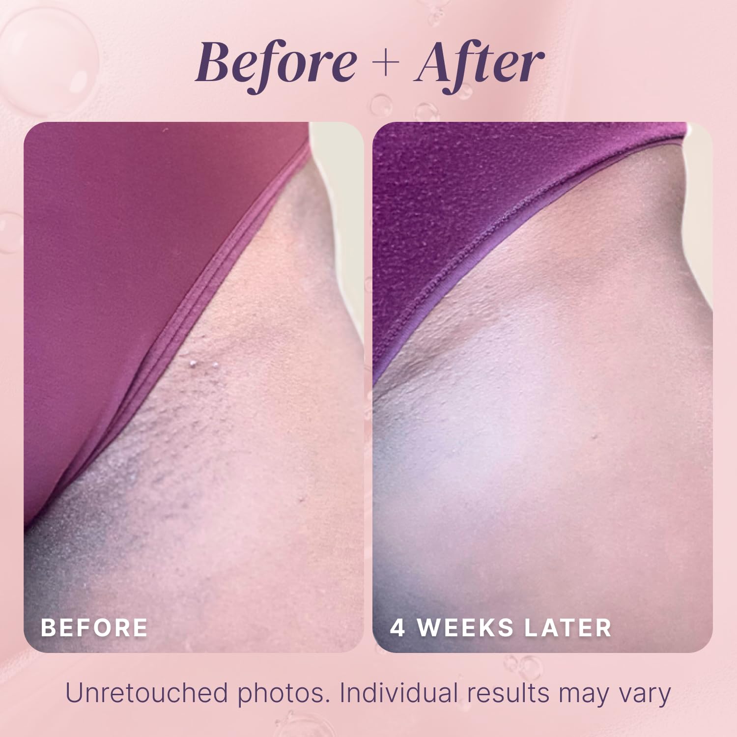 Divine Derriere Easy-to-Use Roll-On bottle for precise on the spot treatment