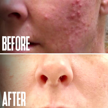 Routine visage avec le peel glycolique Divine Derriere