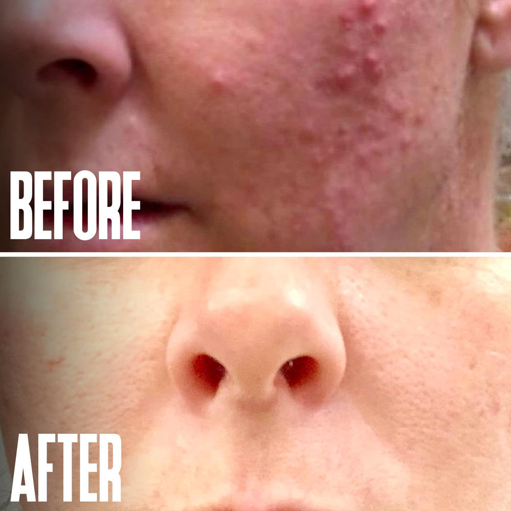 Routine visage avec le peel glycolique Divine Derriere
