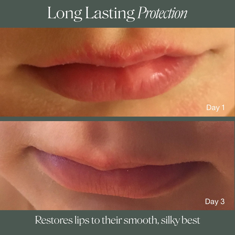 Compact packaging shown for travel-friendly lip care.