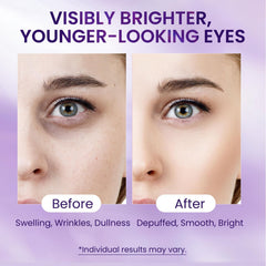 Doracome suero para ojos, aplicación suave en la zona de ojeras; posible reducción de hinchazón.