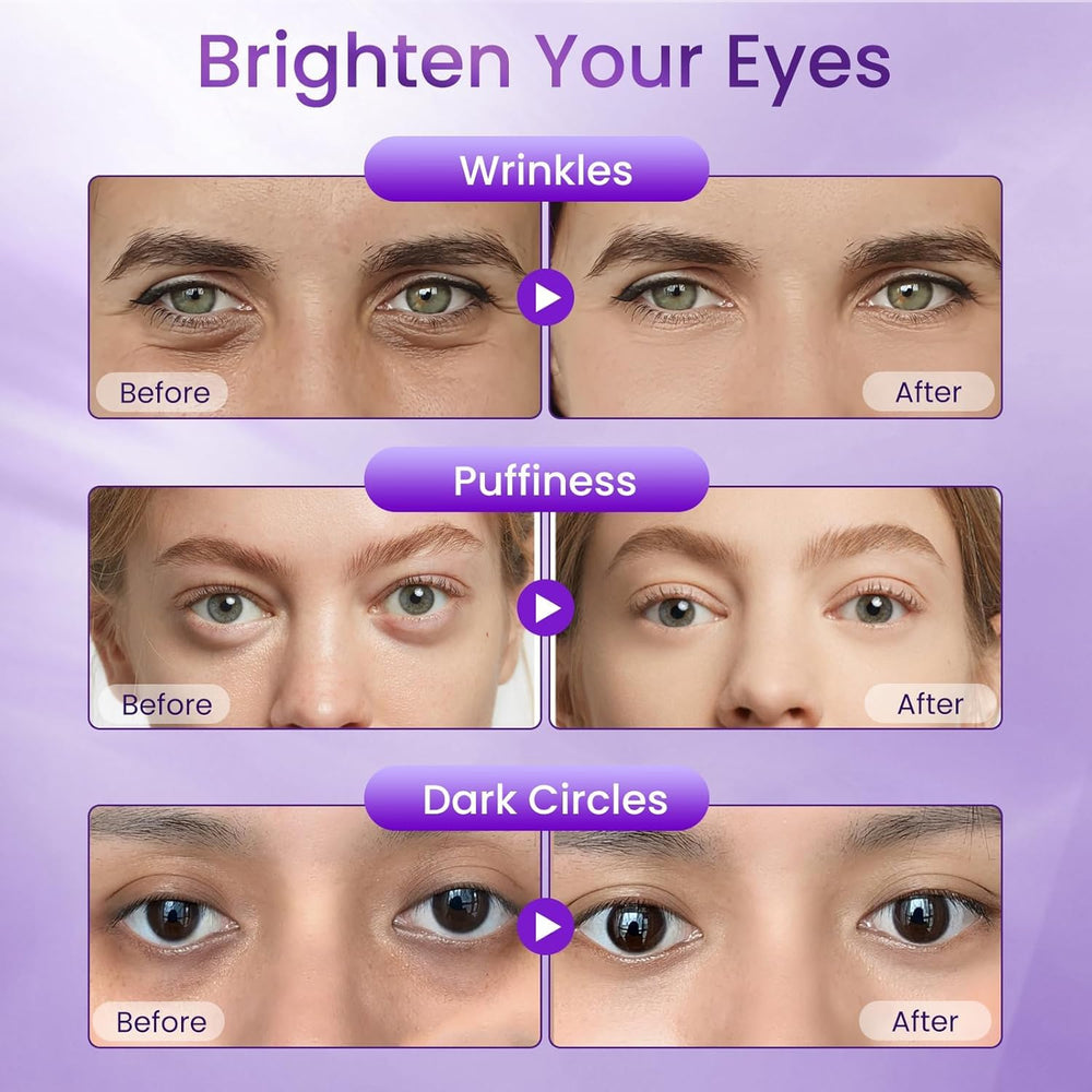Doracome crema ojos retinol, apta para piel sensible.