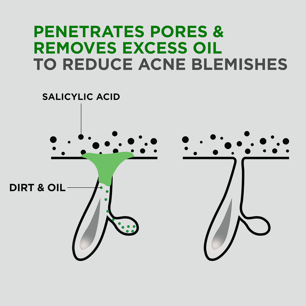 Dove Men+Care Acne Clear: enjuague rápido para piel limpia