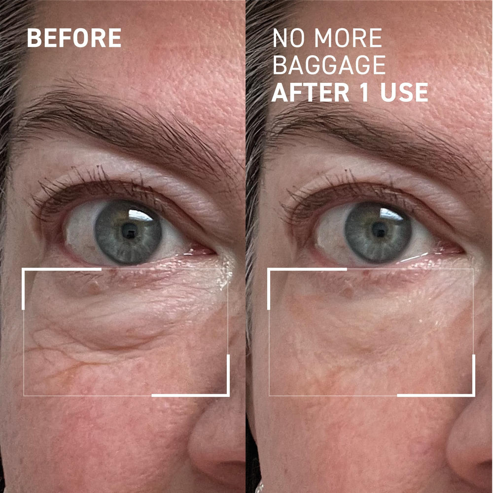 Dr. Brandt Needles No More: aplicación en gel caliente para efecto suave