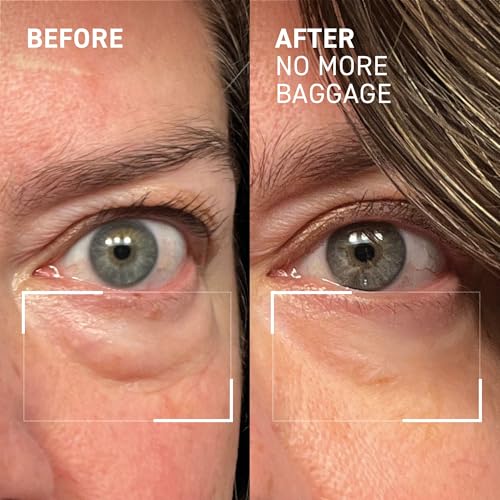 Dr. Brandt Needles No More: contorno de ojos tensado para aspecto estable
