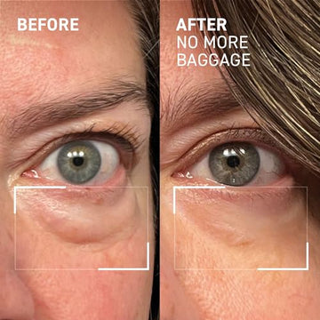 Dr. Brandt Sin Agujas Tamaño Mini 0-5oz: formato portátil ideal para viaje