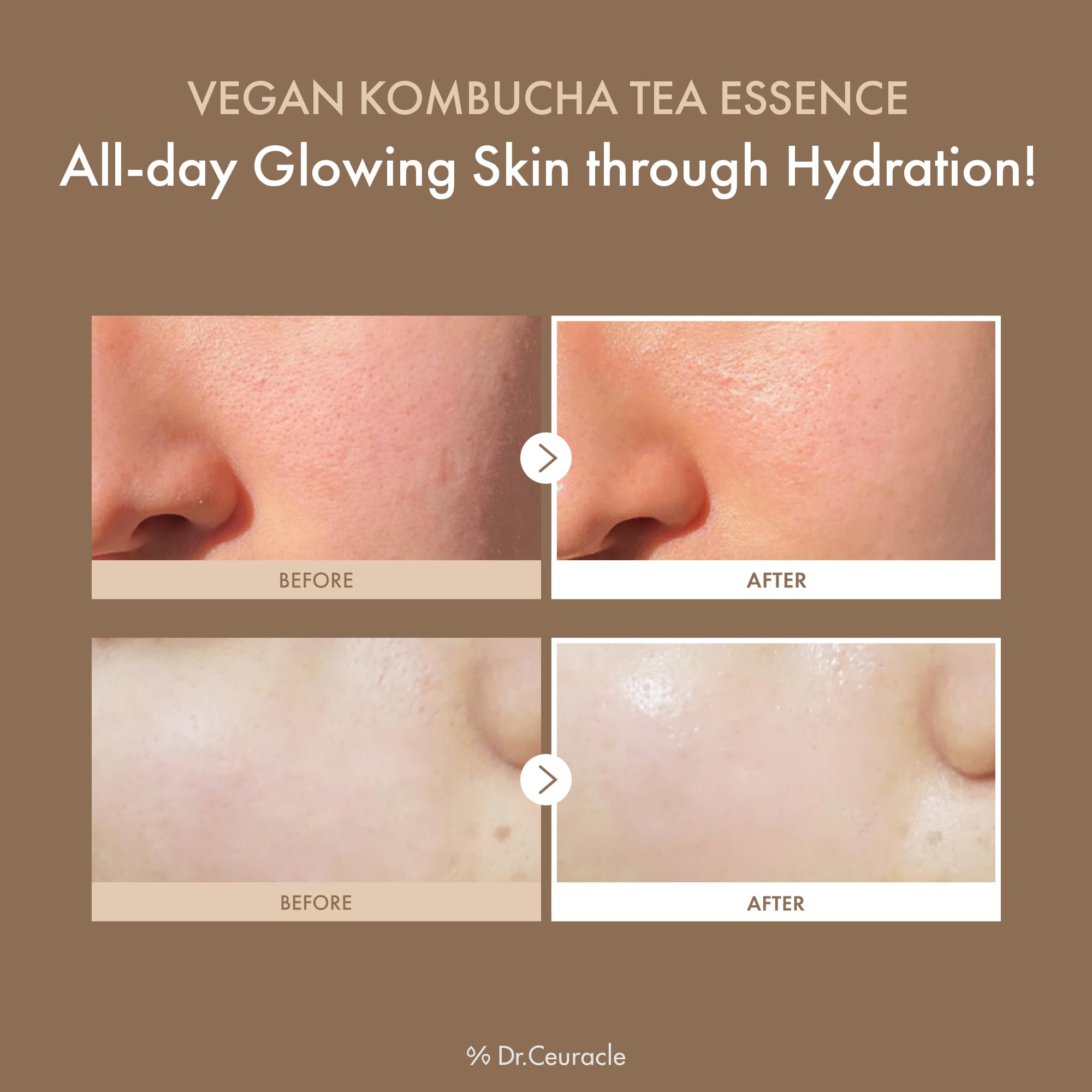 Esencia Dr. Ceuracle con textura lechosa, absorción rápida para rostro fresco.