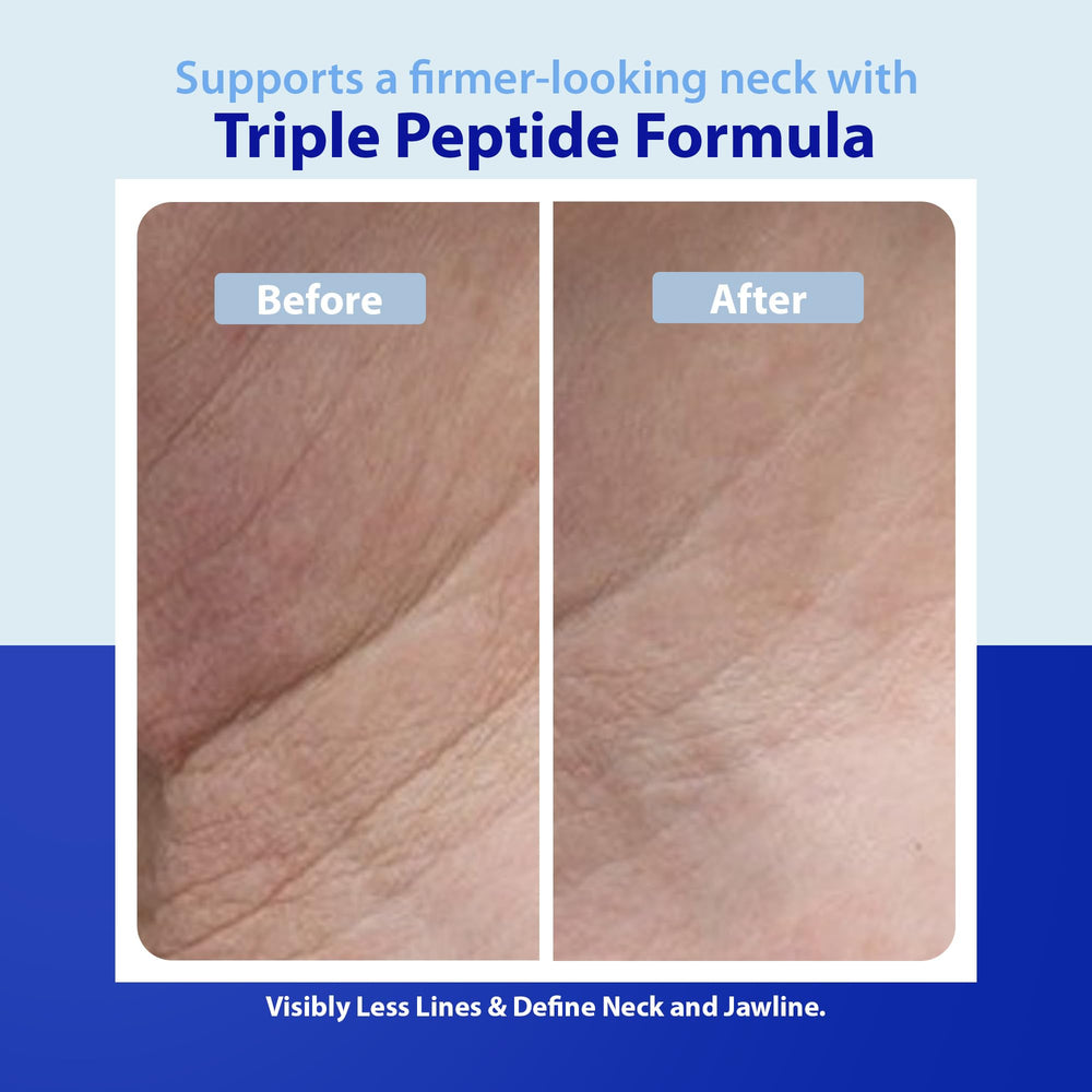 Dr. Denese retinol y ácido hialurónico para cuello hidratado y suave.