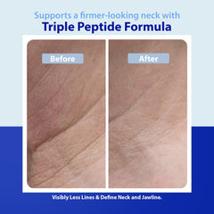 Dr. Denese retinol y ácido hialurónico para cuello hidratado y suave.
