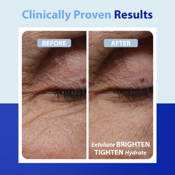 Dr. Denese SkinScience Advanced Firming Facial Pads hidratación y elasticidad