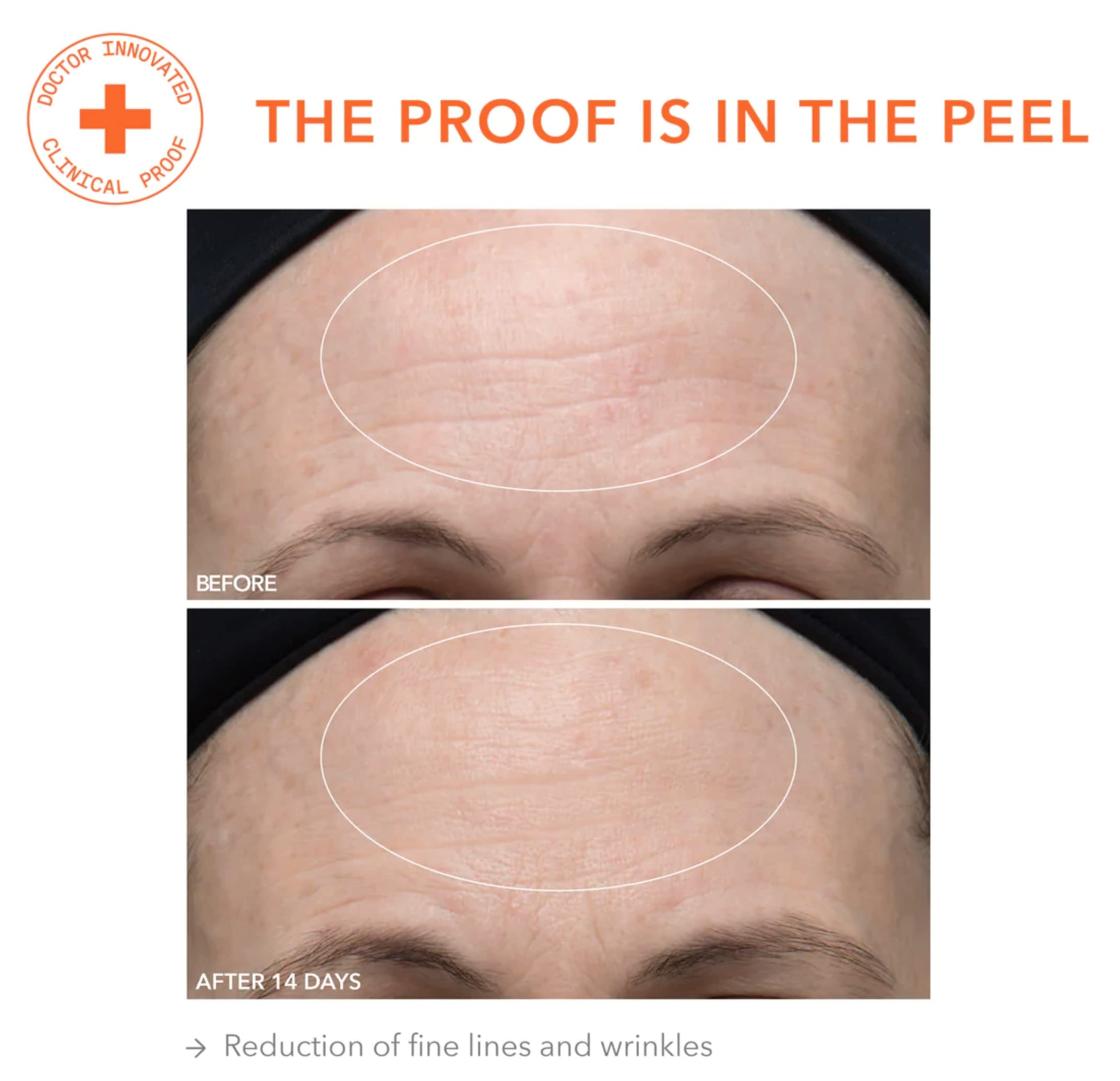 Dr. Dennis Gross Alpha Beta Ultra Suave peeling diario poros visibles reducidos y tez uniforme