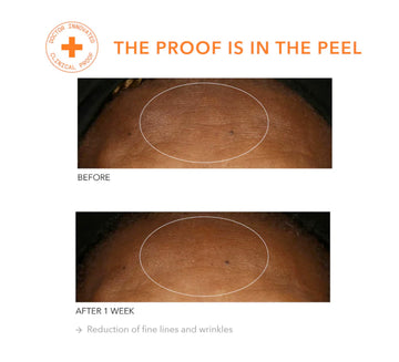 Dr Dennis Gross Alpha Beta Universal Daily Peel: cuidado diario para piel balanceada
