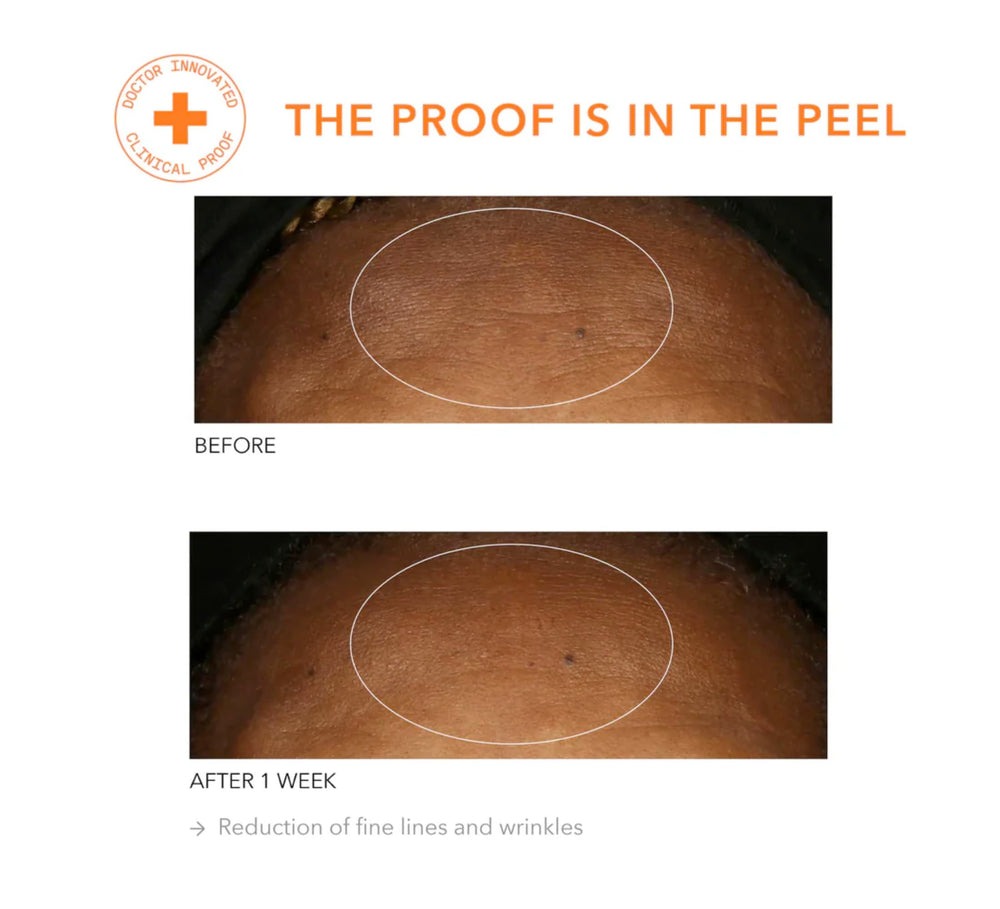 Dr Dennis Gross Alpha Beta Universal Daily Peel: cuidado diario para piel balanceada