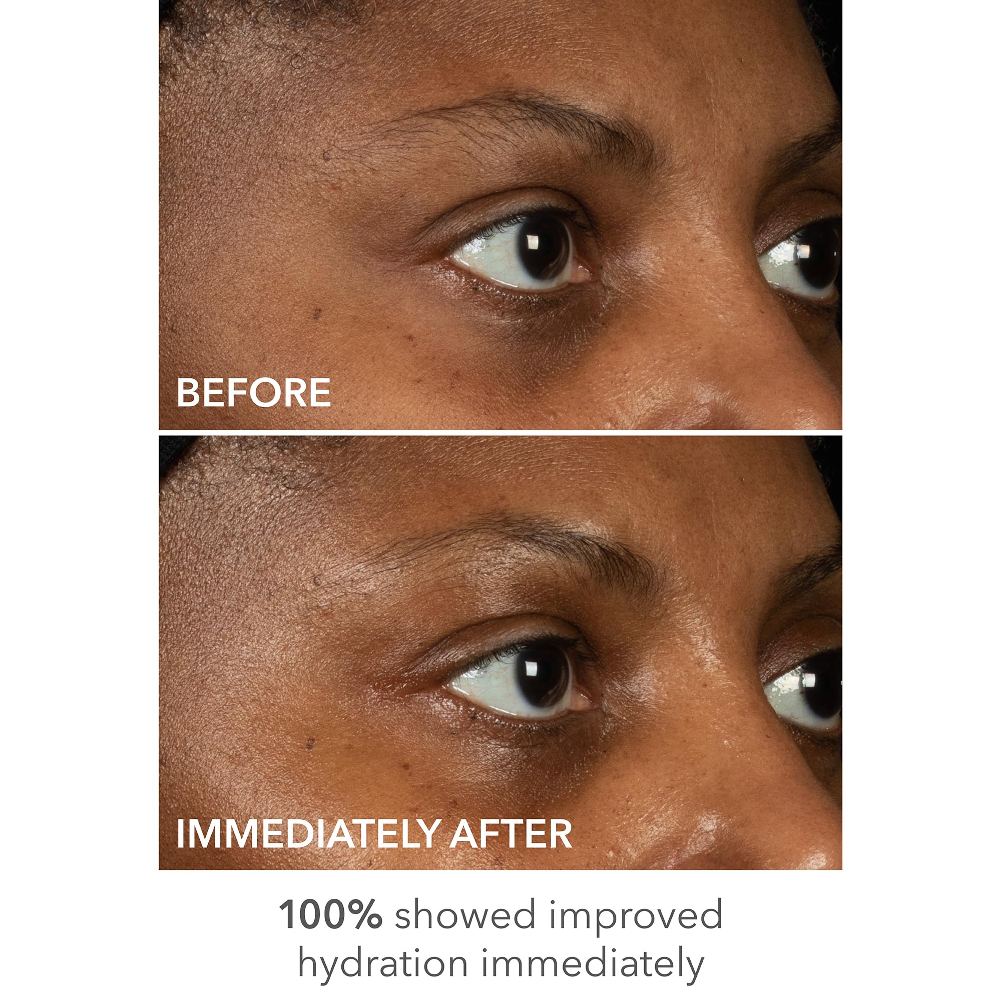 Uso en casa con DermInfusions Lift + Repair para reducción de hinchazón visible