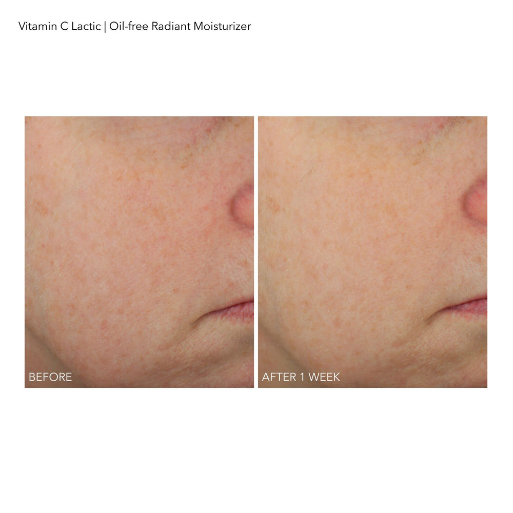 Dr Dennis Gross hidratante Vitamina C láctico, empaque elegante para la rutina de cuidado.