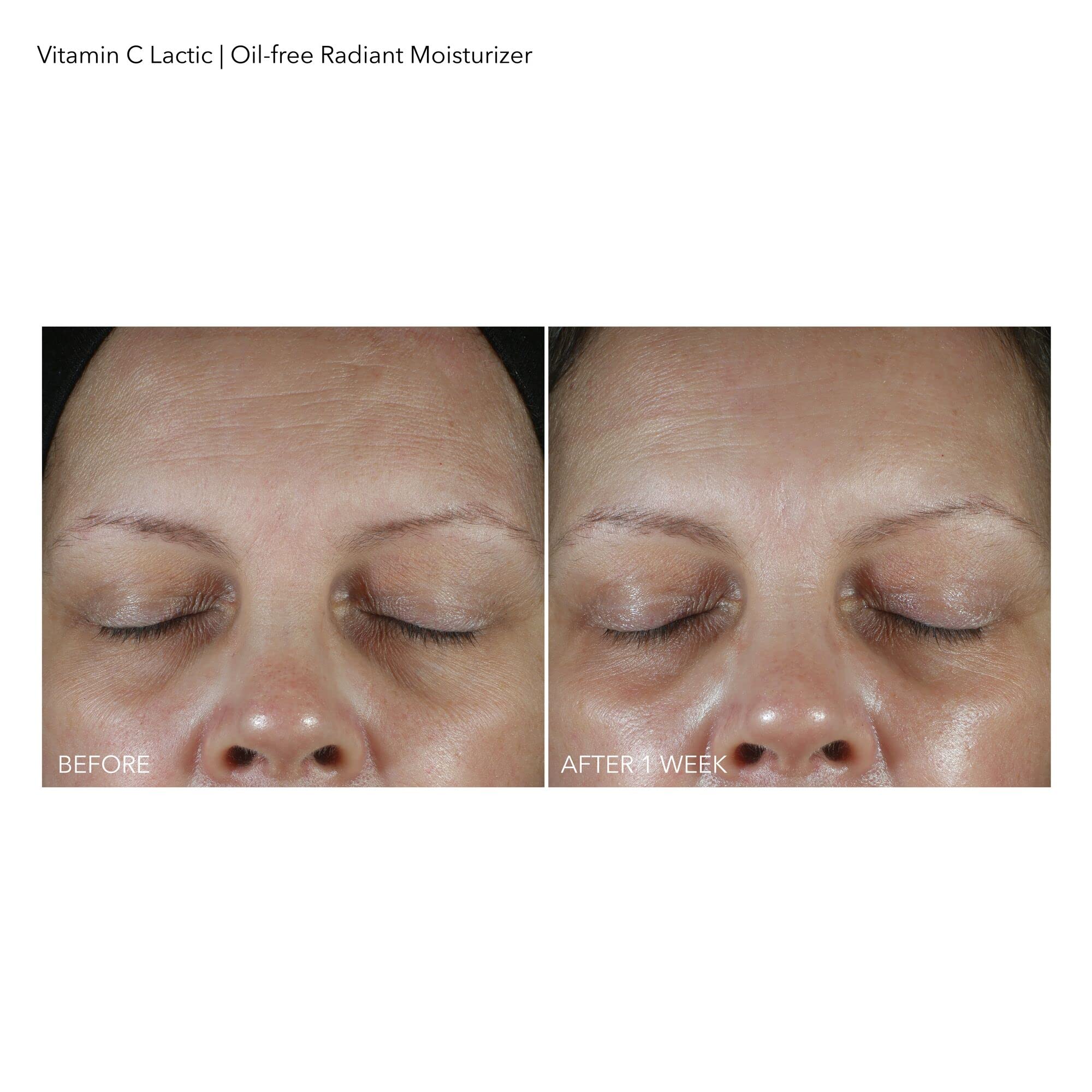 Dr Dennis Gross hidratante Vitamina C láctico, piel radiante tras la aplicación.