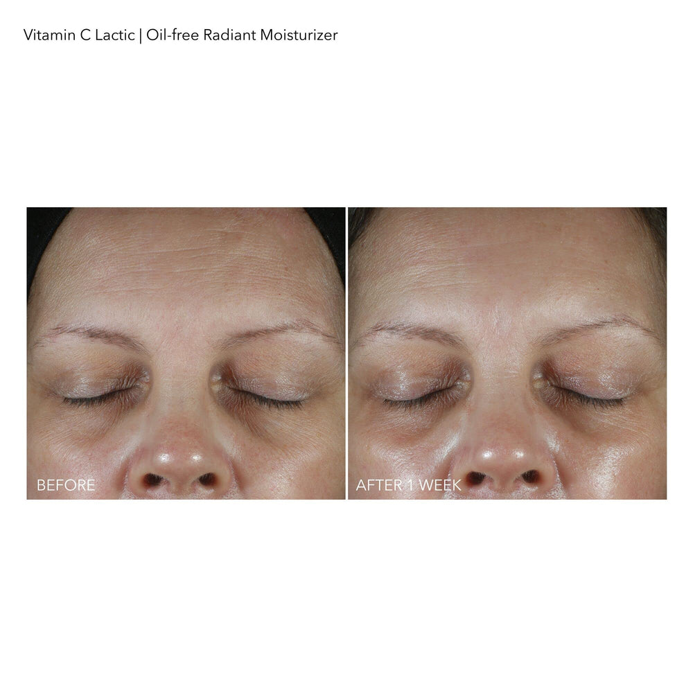 Dr Dennis Gross hidratante Vitamina C láctico, piel radiante tras la aplicación.