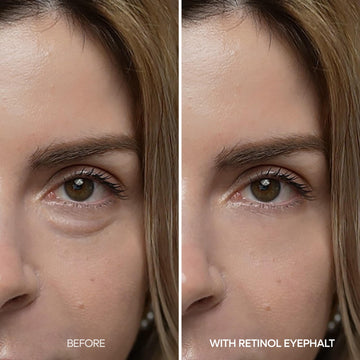 Dr. Melaxin Contorno Ojos Niacinamida Ceramidas: hidrata y cuida la barrera de la piel.