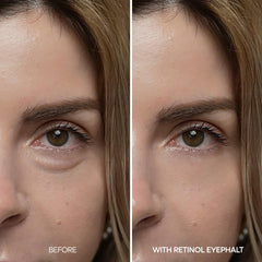 Dr. Melaxin Contorno Ojos Niacinamida Ceramidas: hidrata y cuida la barrera de la piel.
