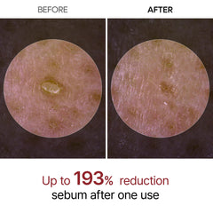 Dr.Melaxin Peel Shot Glow: exfoliante-suero de arroz para renovación suave.