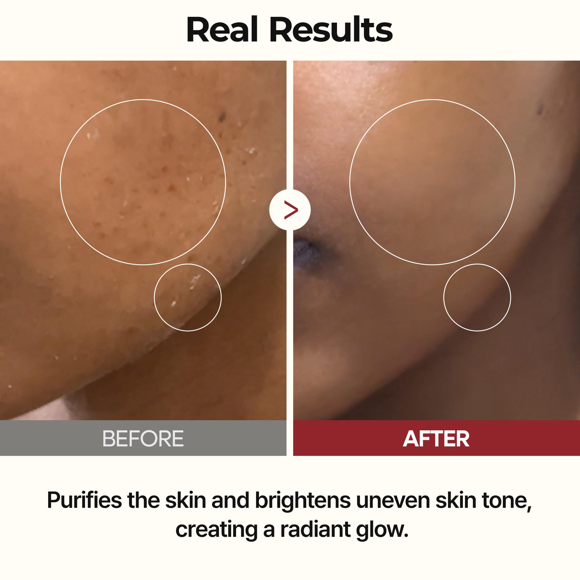 Envase de 200 ml de Dr.Melaxin Peel Shot Glow Rice Toner, opción diaria.