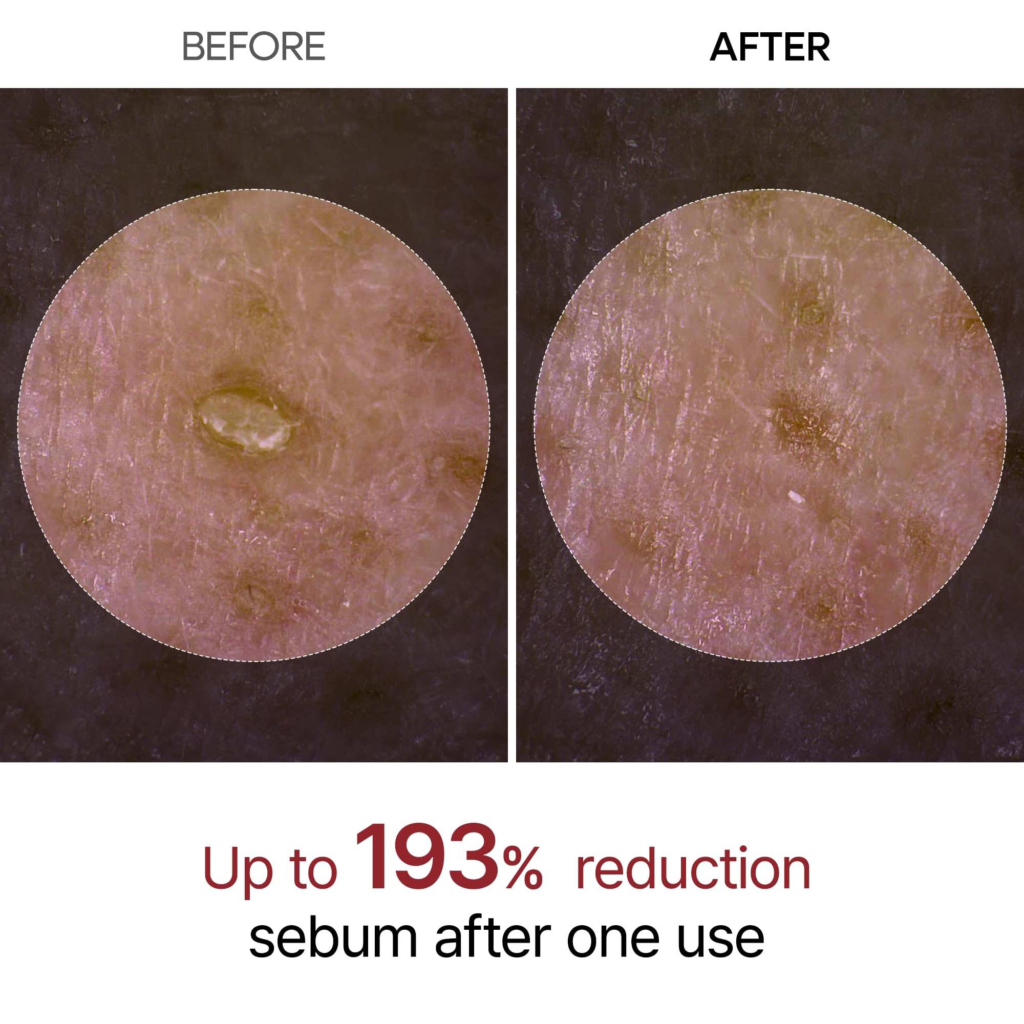 Dr.Melaxin Peel Shot Glow, poros visibles reducidos gracias a su fórmula suave