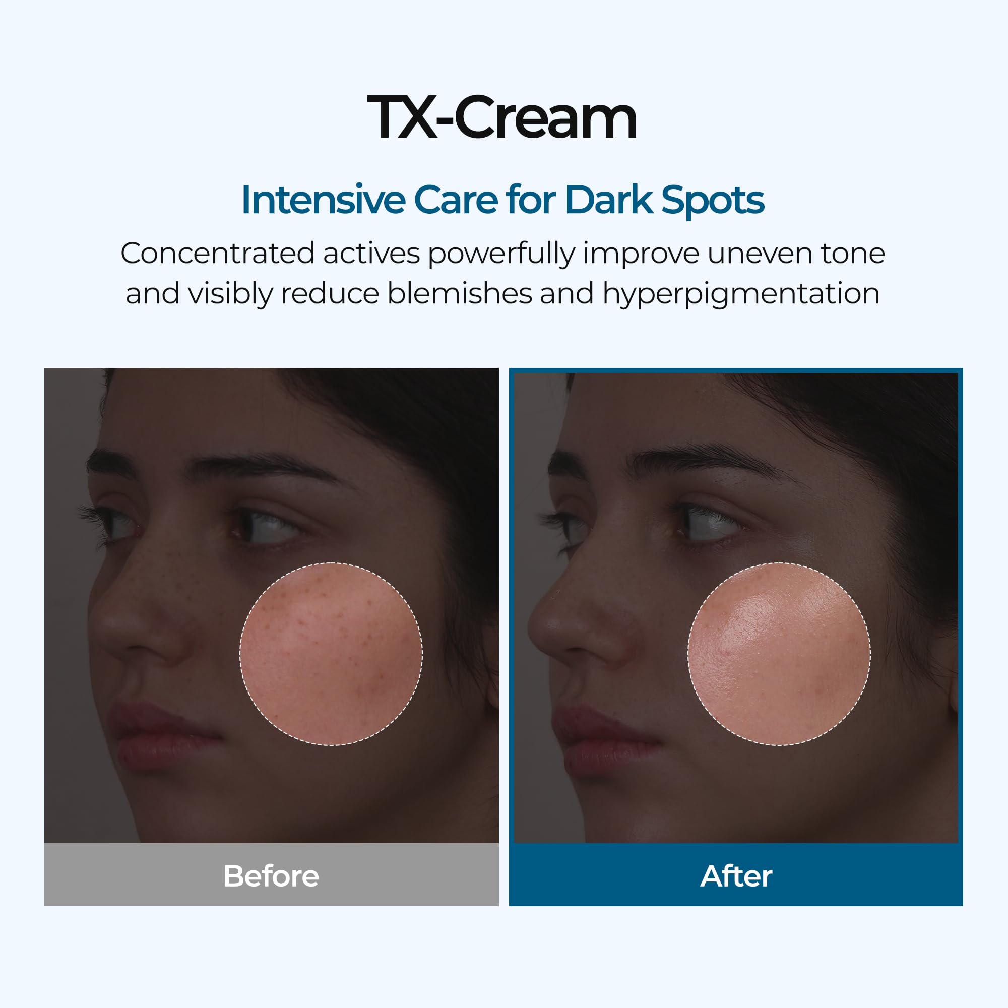 Dr.Melaxin TX crema aplicación diaria para tono más uniforme.