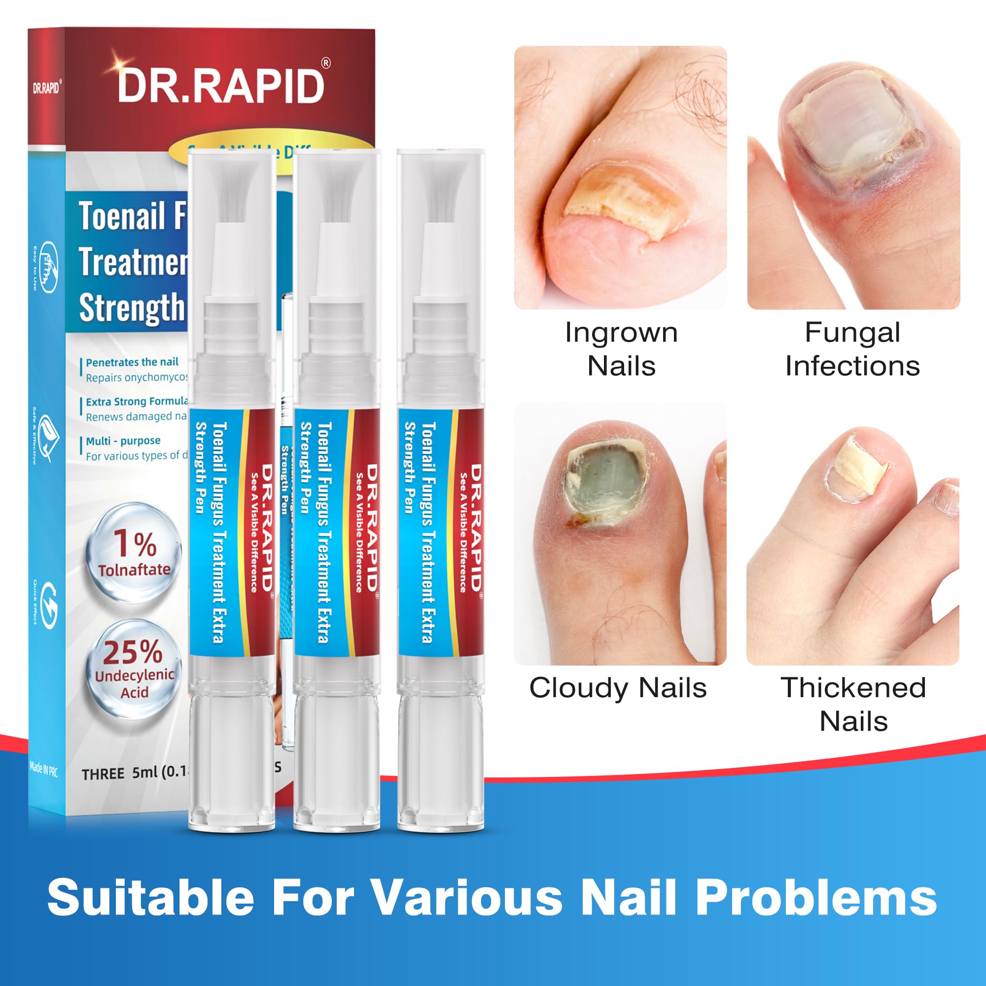Uñas gruesas y dañadas antes del tratamiento DR.RAPID.