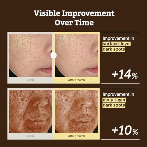 Ingrédients Niacinamide 10% et TXA 4% mis en avant par Dr Reju-All
