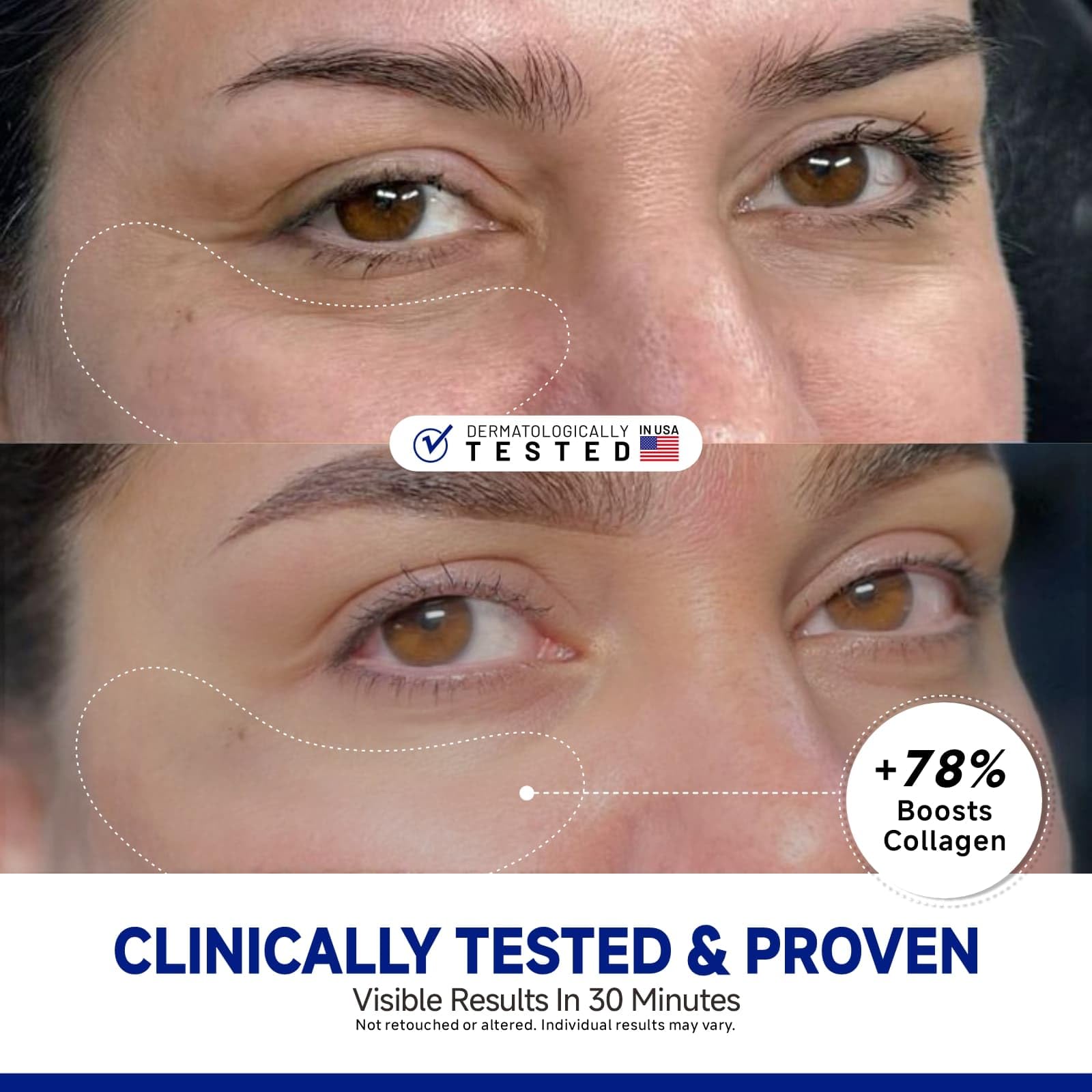 Dr Vincent Patchs Yeux Peptide – adhérence sans glisse pour une pose fiable.