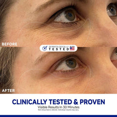 Dr Vincent parches ojos con colágeno para suavizar la zona inferior.