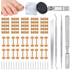 DreamCatching corrector de uñas encarnadas: conjunto para corrección precisa y alivio diario