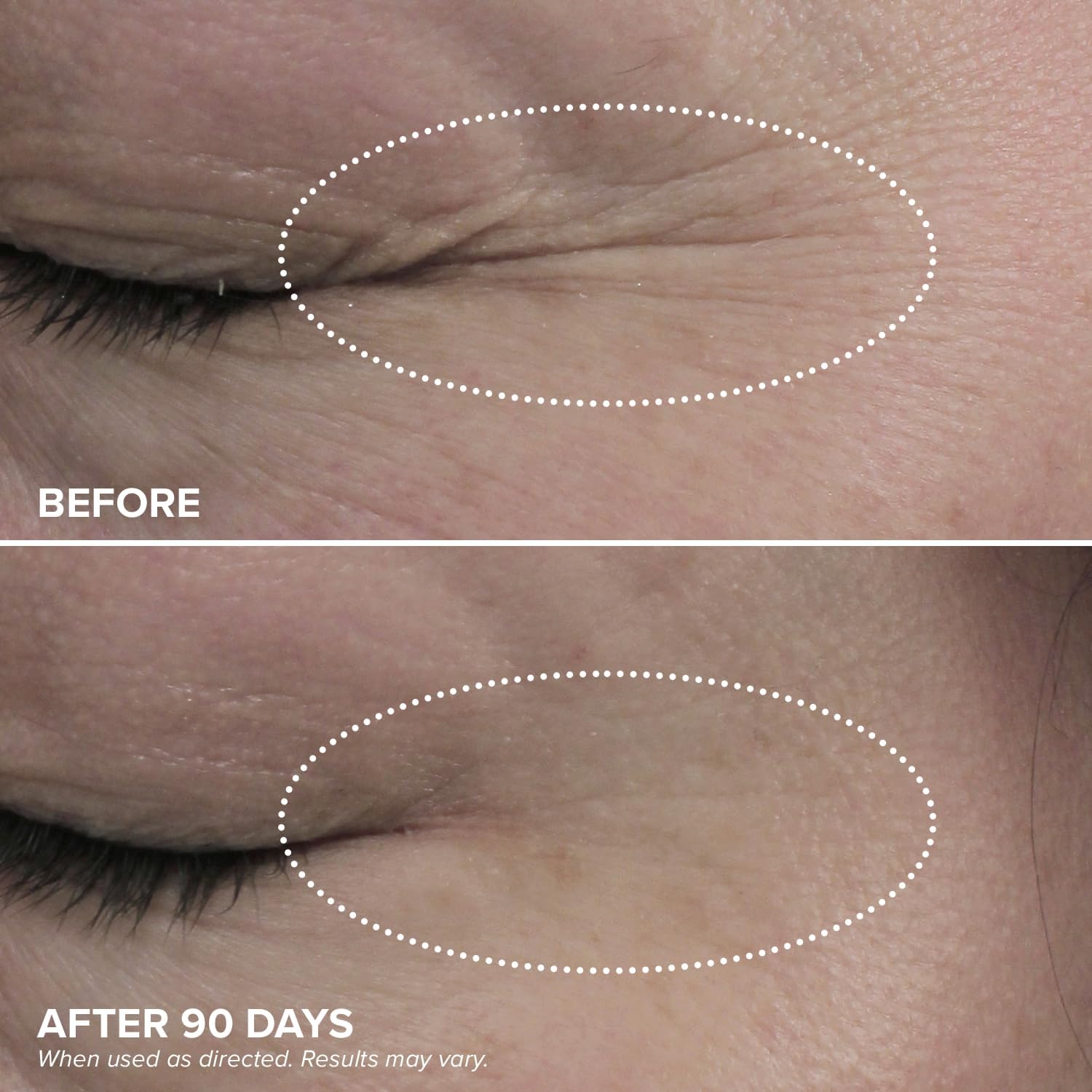 DRMTLGY HPR crema de ojos, aplicación manual en rostro fresco