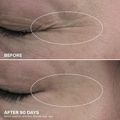 DRMTLGY HPR crema de ojos, aplicación manual en rostro fresco
