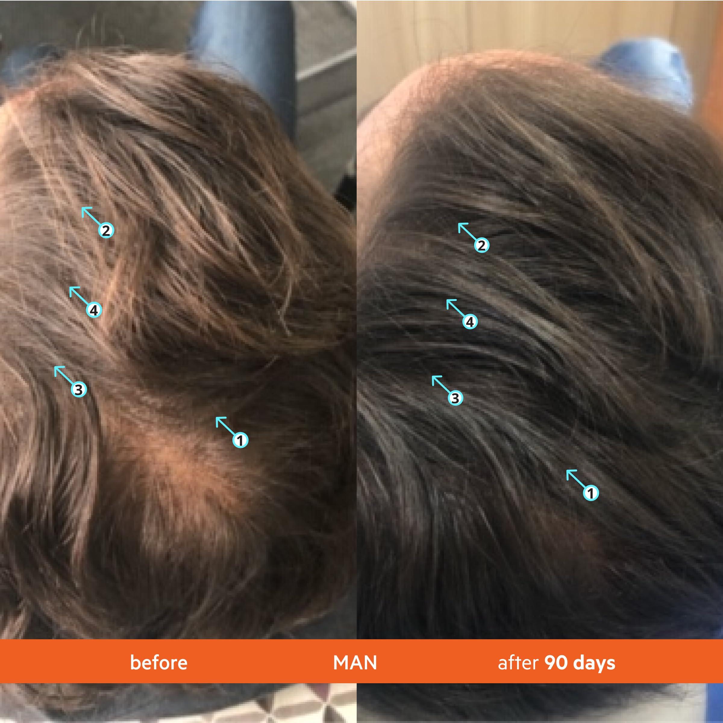 Cabello con aspecto más lleno tras uso constante de Revita.