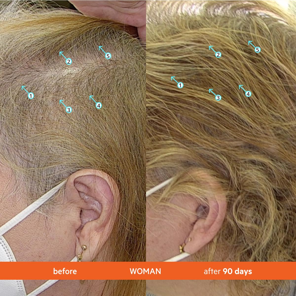 DS Laboratories Revita Hair Density tablets pouring into hand for easy daily intake