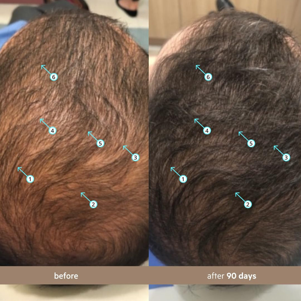 Textura ligera y no grasa del suero Spectral Hombres