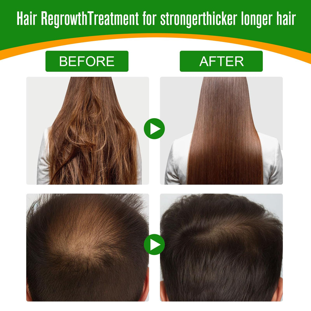 Dvoevivh Uso diario para cabello seco y dañado.