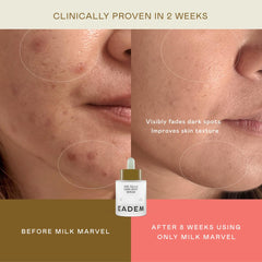 EADEM Milk Marvel Serum: aplicación en manos para absorción rápida.