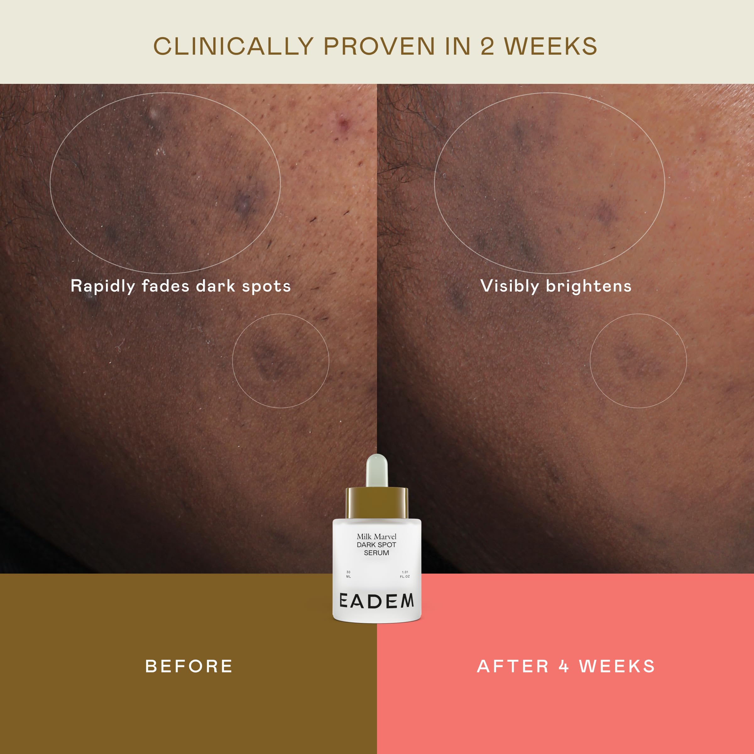 EADEM Milk Marvel Serum: piel más uniforme tras uso gradual.