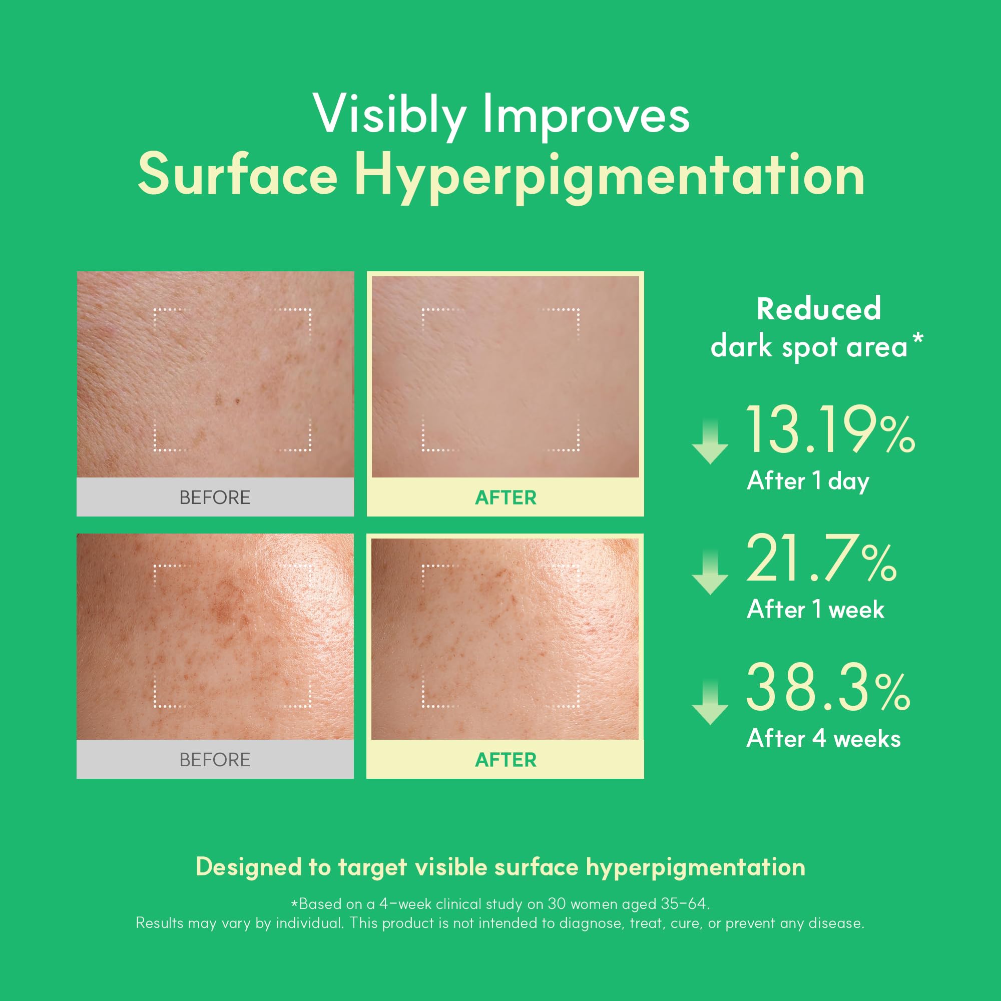 Aplicación diurna con Easydew DW-EGF Melatoning Ampoule para cuidado suave.