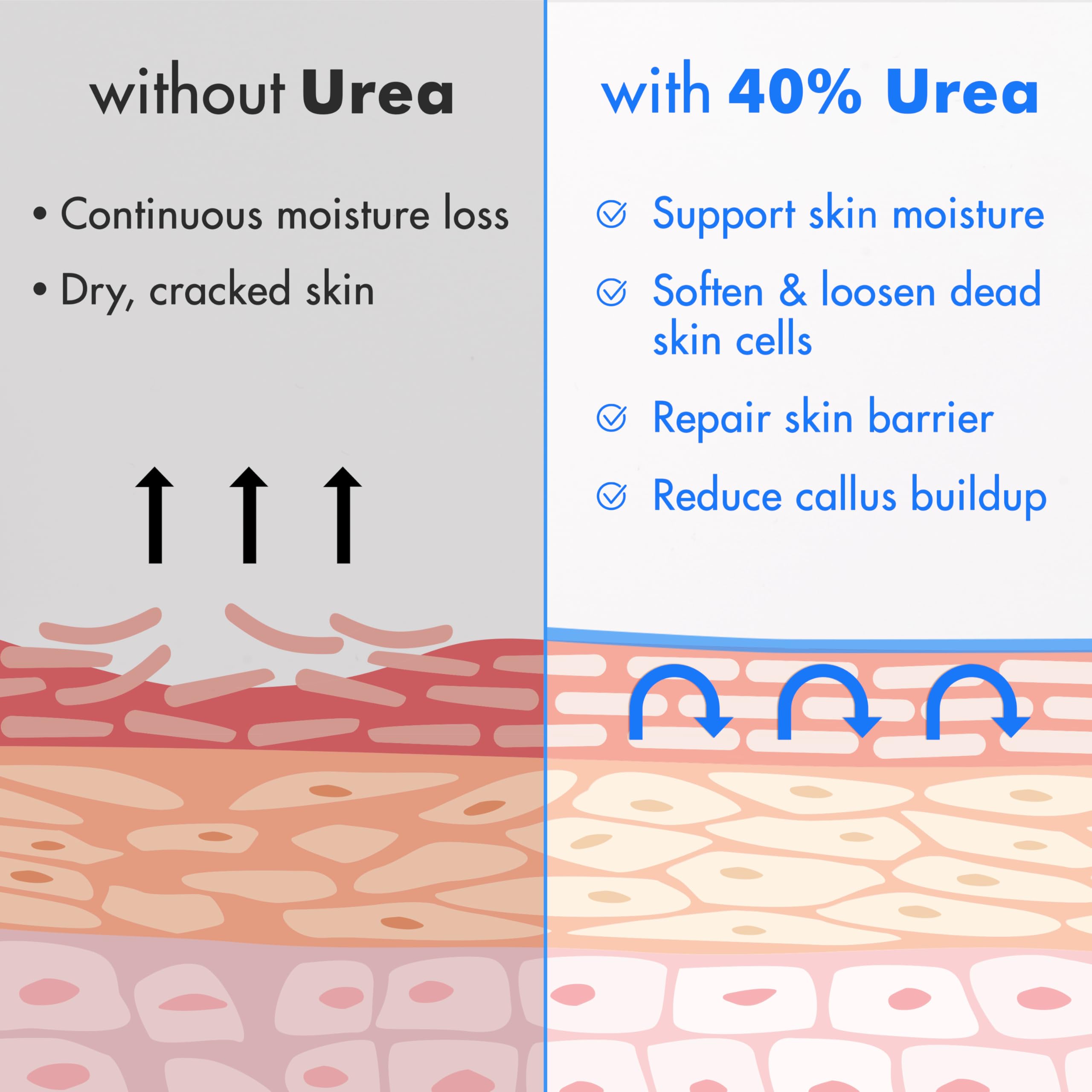 Ebanel Crema Urea 40% hidrata profundamente pies, previene sequedad.
