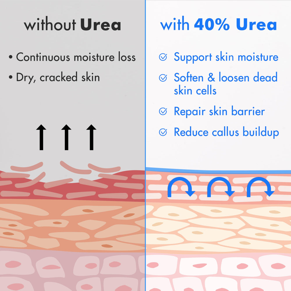 Ebanel crema urea 40% con hidratación intensa para pies.